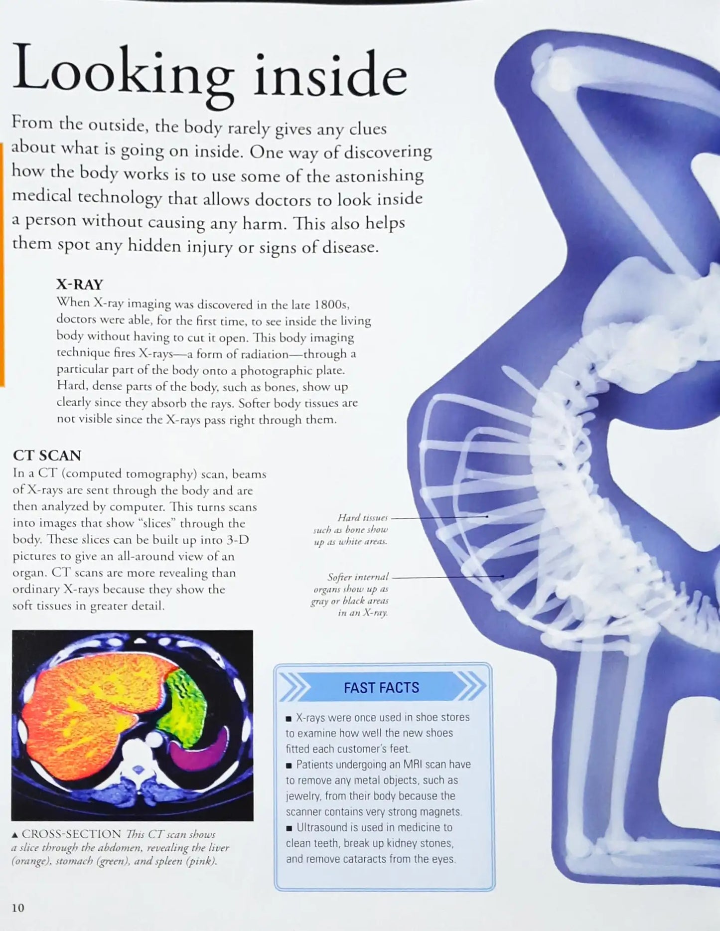 Smithsonian Visual Encyclopedia - Human Body : A Visual Encyclopedia